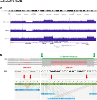 Stepwise use of genomics and transcriptomics technologies increases diagnostic yield in Mendelian disorders